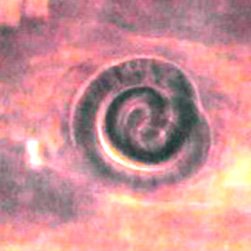 trichinella spiralis macho y hembra